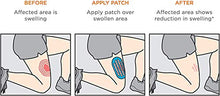 KT Tape Recupero Plus Patch Edmea Cotone, Nero, Taglia Unica